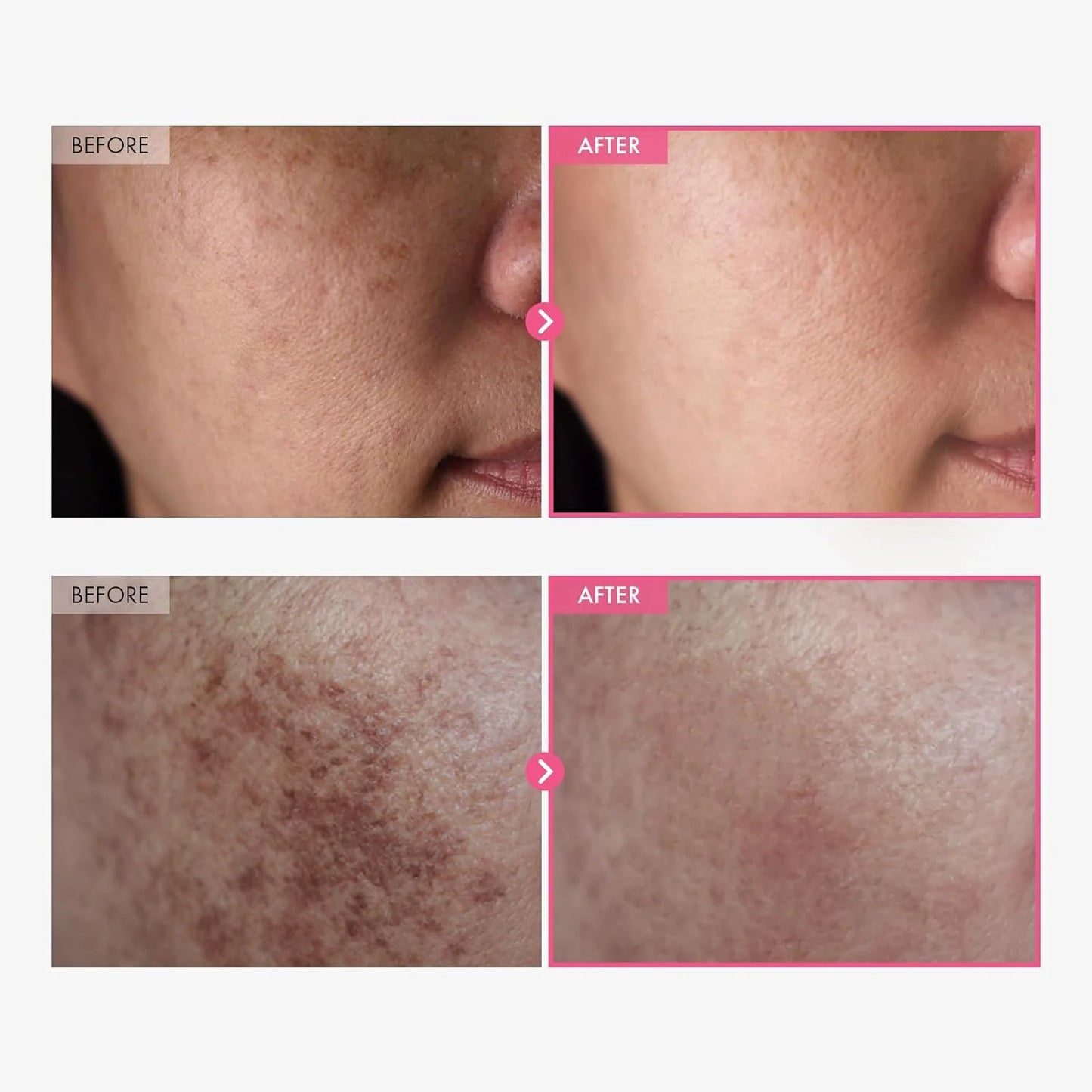 VITACLEAR™ Dark Spot Corrector